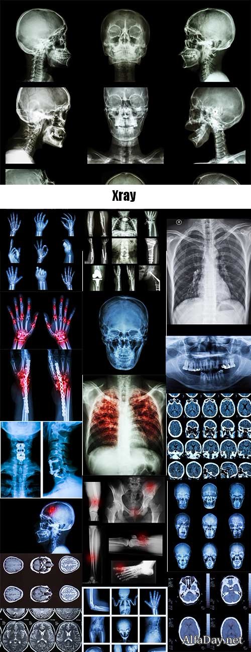 ������� - ���� �� ������ ���� / Xray